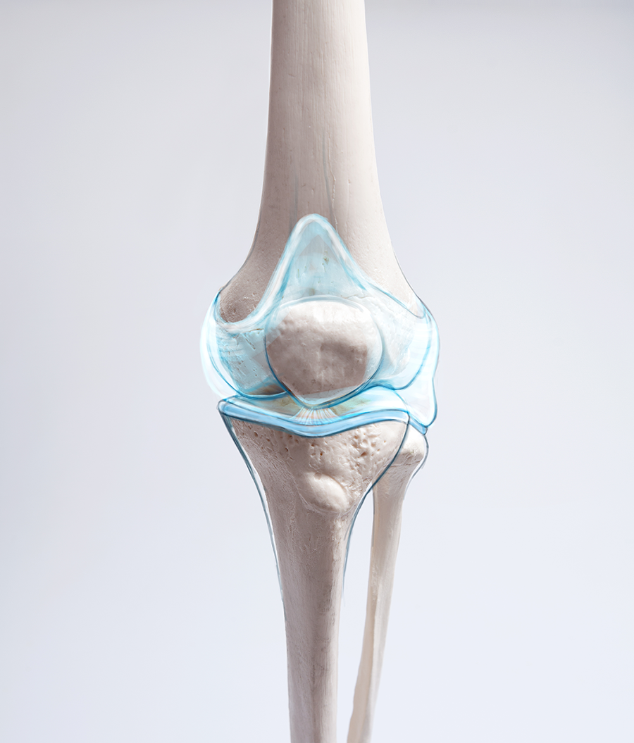 Knee Cartlidge re-build